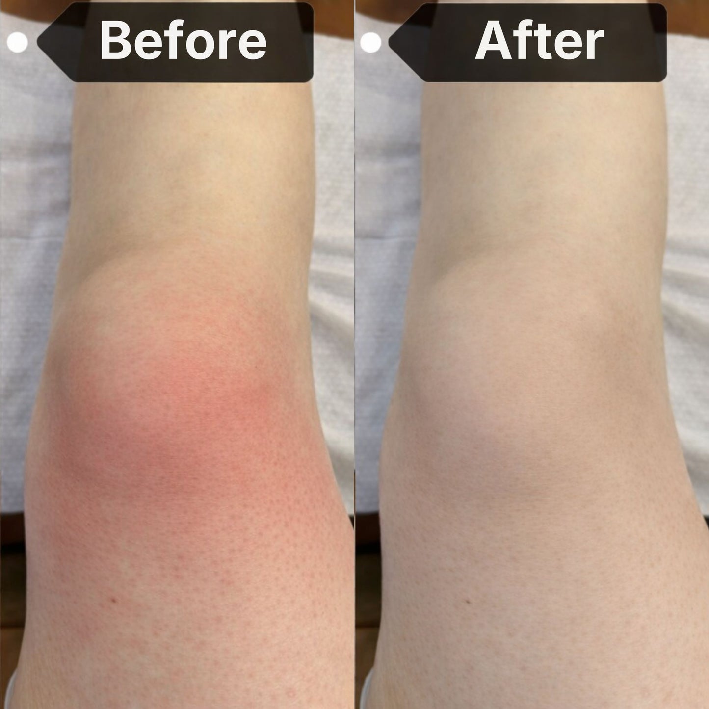 Red Light Therapy for Knee Pain & Stiffness + Heating + Massage