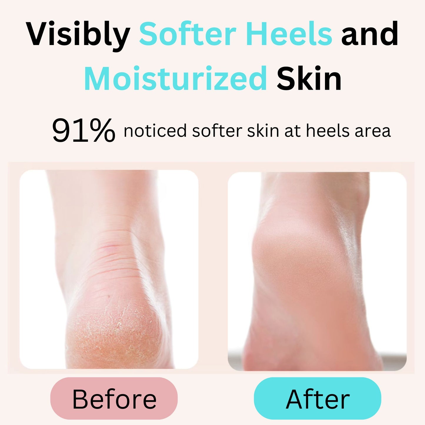 Silvergel Moisturizing Heel Open Toe Socks with Essential Oil (4 Socks)