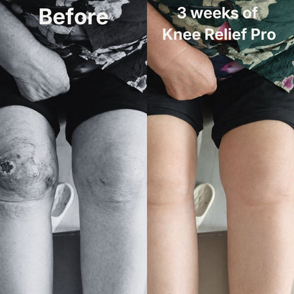 Red Light Therapy for Knee Pain & Stiffness + Heating + Massage